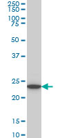 WB - UCHL3 Antibody (monoclonal) (M01) AT4456a